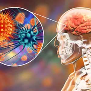 Cns infections treatment in Hyderabad