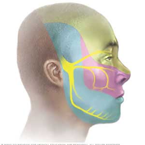 Trigeminal Neuralgia Treatment in Hyderabad